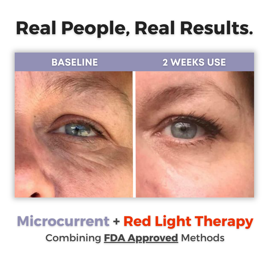 Toneur™ EyeCare Pro Under Eye Red Light Therapy